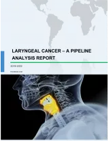 Laryngeal Cancer - A Pipeline Analysis Report